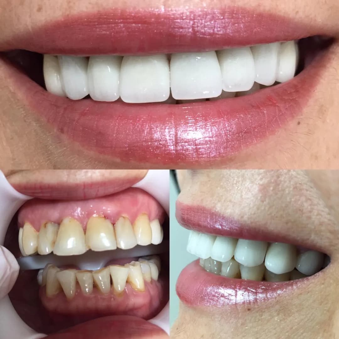 MHG Dental Klinik(Dt. Muhammed Hanifi Güllüce) — Dental Clinics in Istanbul