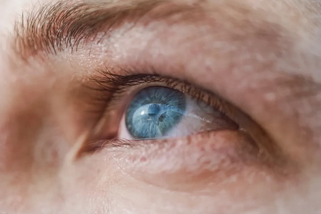 Lasik İstanbul - Augen Lasern Türkei | Lasik Eye Surgery Turkey | Cataract Surgery | Relex SMILE | Femto Laser
