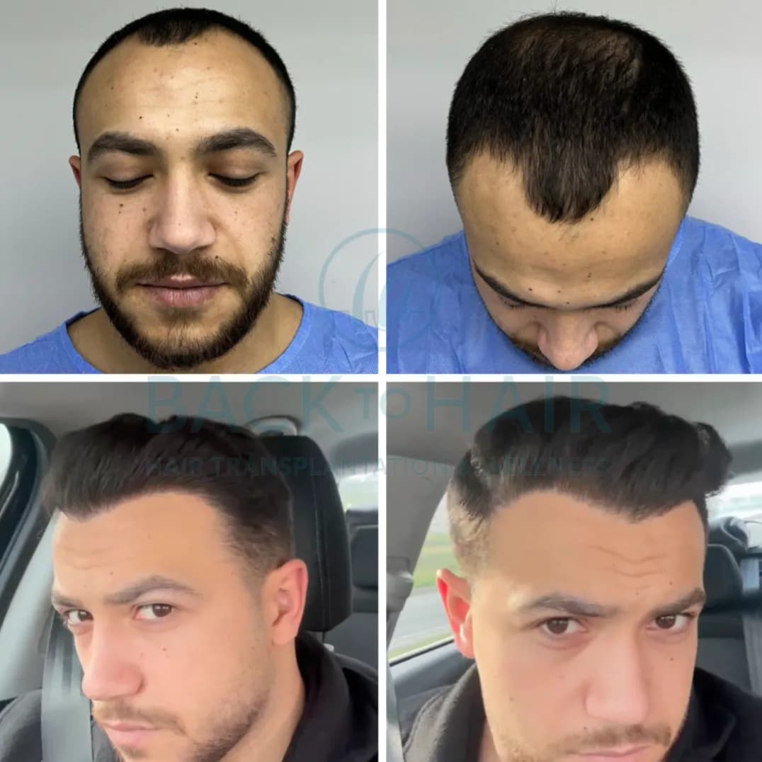 Back to Hair İstanbul — Dermatology & Skin Care in Istanbul