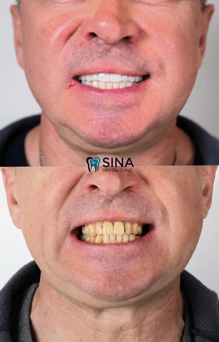 Sina Dental Clinic — Dental Clinics in Istanbul