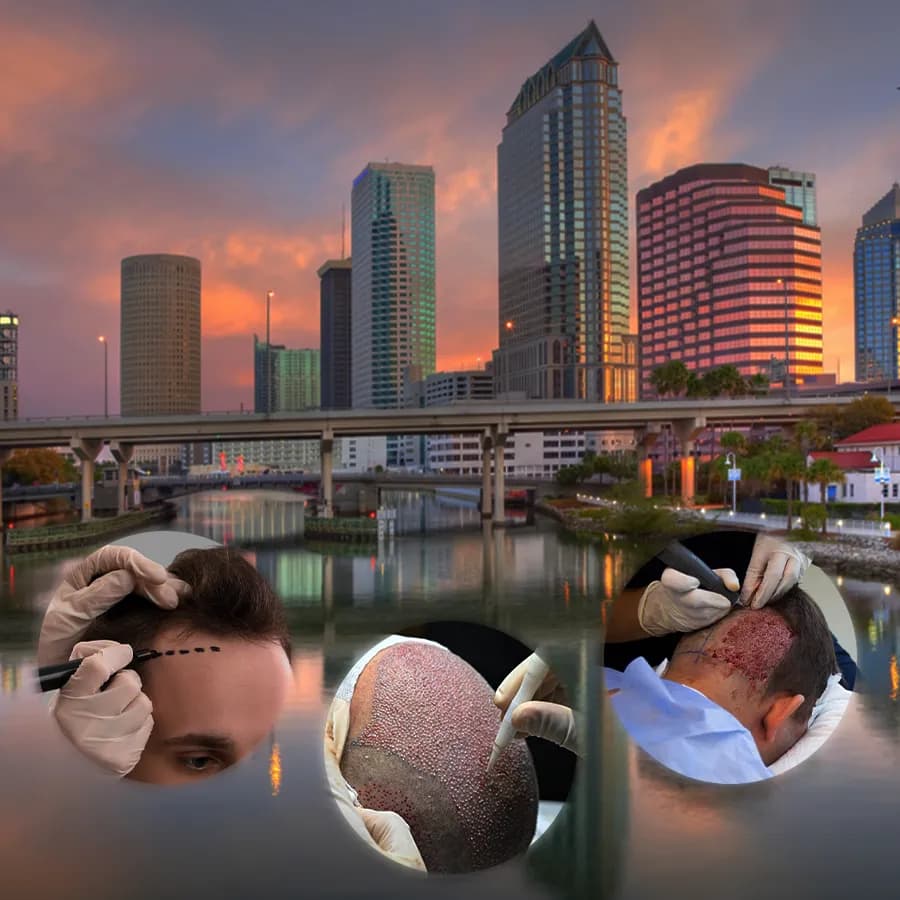 Turkish Hair Transplants - AFKAR - Hair Transplant Turkey, Istanbul — Dermatology & Skin Care in Istanbul