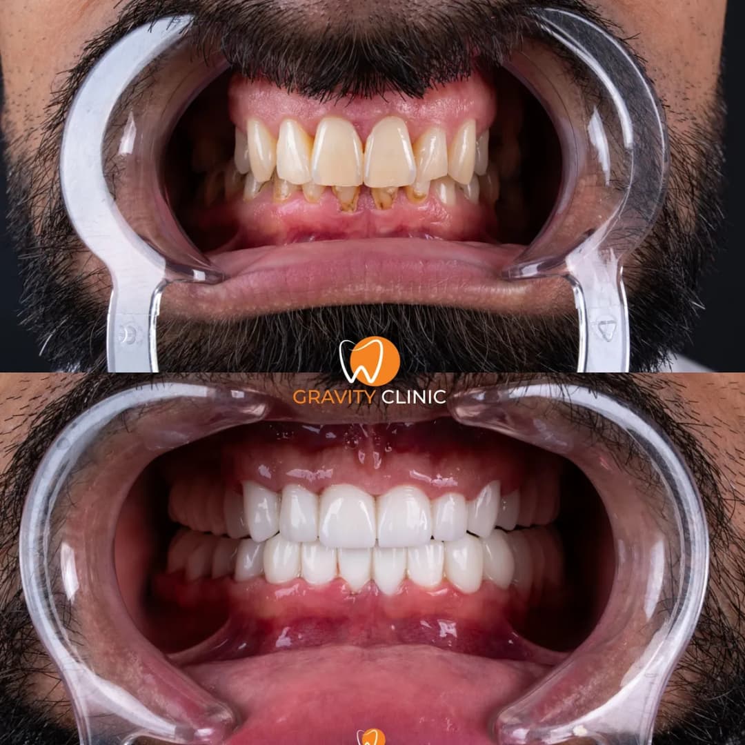 Gravity Clinic — Dental Clinics in Istanbul