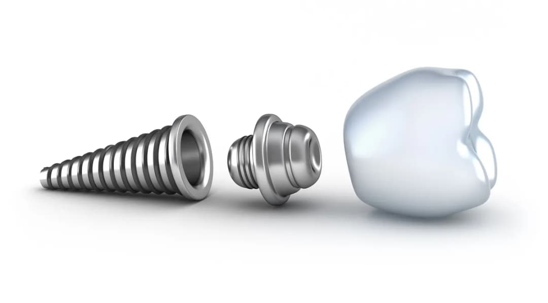 Dental Implant Clinic Thrace — Dental Clinics in Istanbul