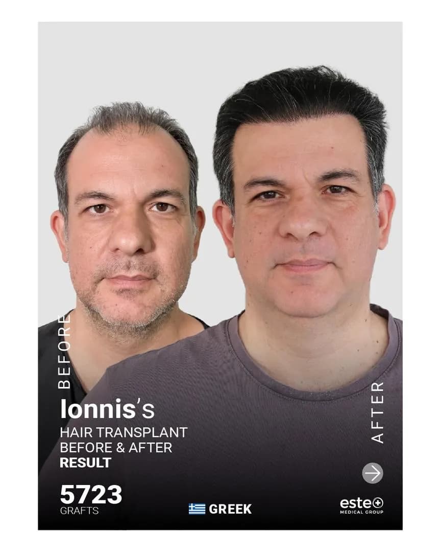 Este Medical - Hair Transplant Clinc Istanbul Türkiye — Wellness Centers & Medical Spas in Istanbul