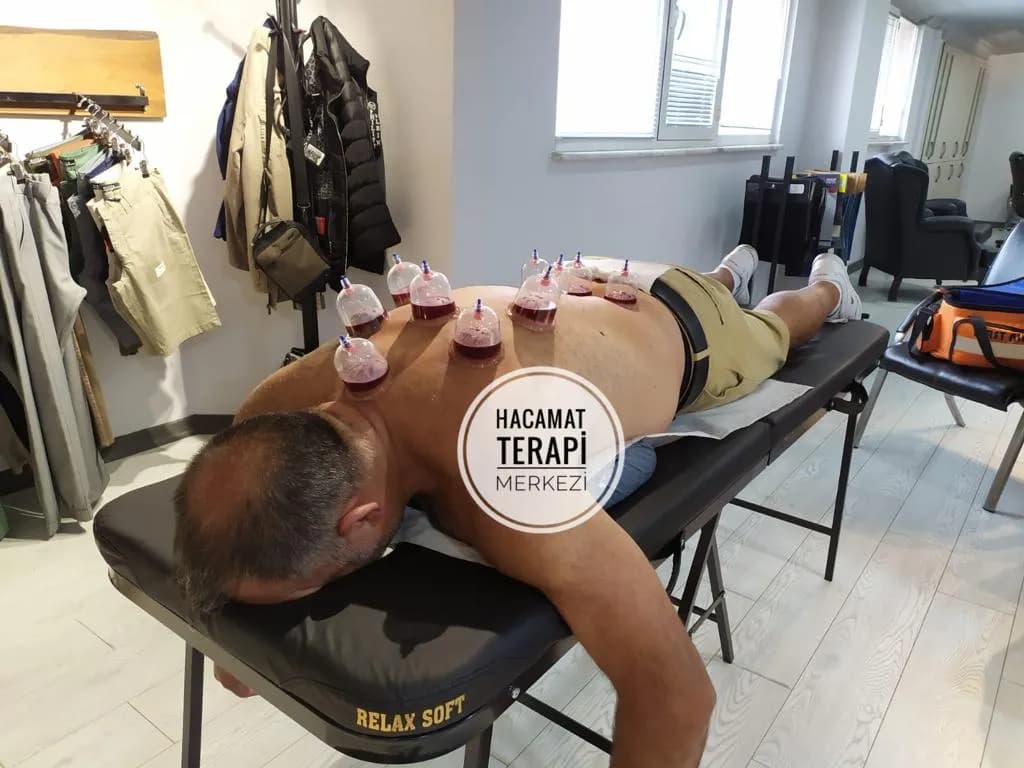 Hacamat Terapi Merkezi / Hacamat ve Sülük Tedavisi