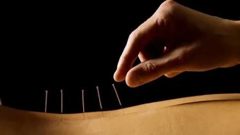 Fatima Acupuncture — Alternative & Holistic Medicine in Istanbul