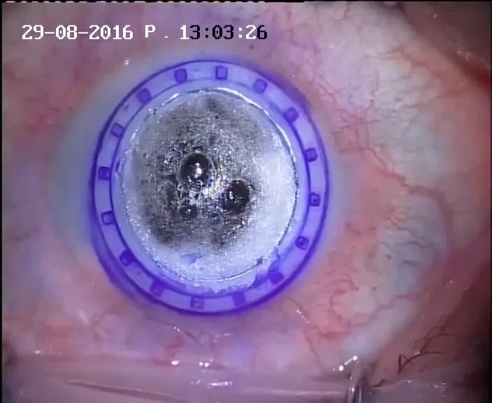 Doç Dr Selim GENÇ (göz hastaliklari ve cerrahisi) özel göz muayensi — Eye Care & Ophthalmology in Istanbul