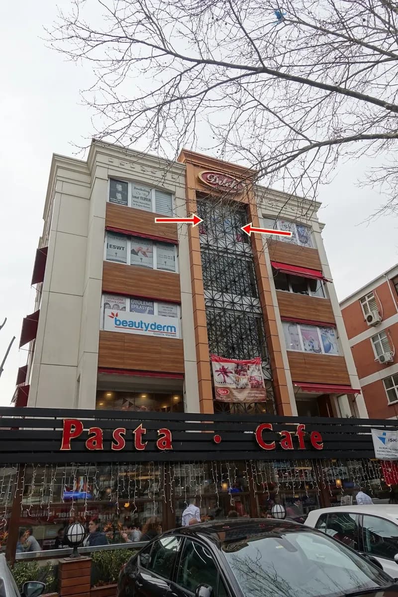 Doç.Dr. Murat Enöz, ENT Doctor, Burun Estetiği, Tip Plasty, Rhinoplasty, Nose Job Surgery, Istanbul