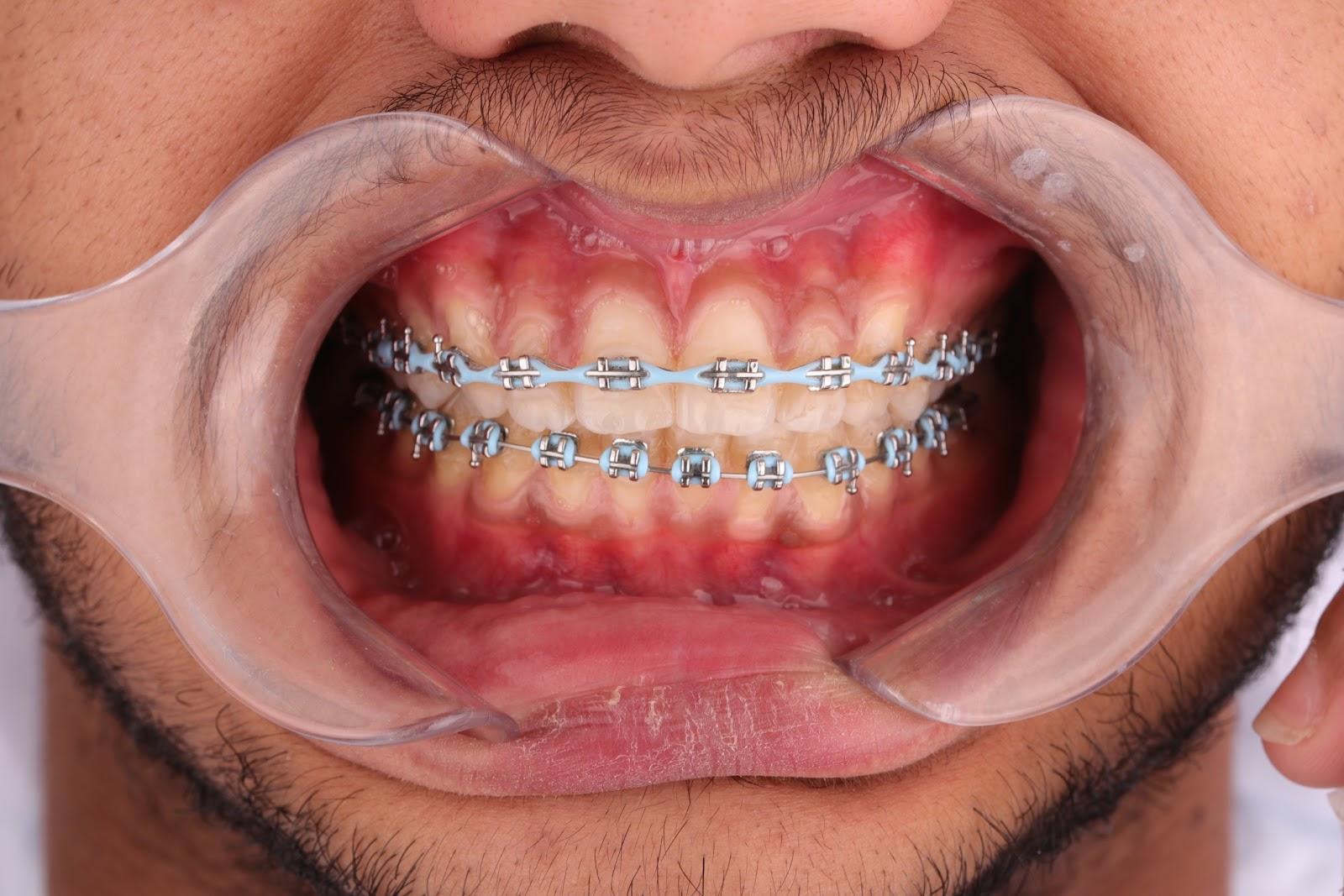 Unique Smile Clinic — صورة 7