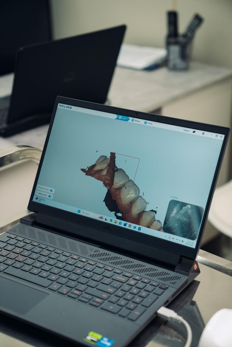 Velcare Orthodontic & Dental Clinic L.L.C — صورة 7