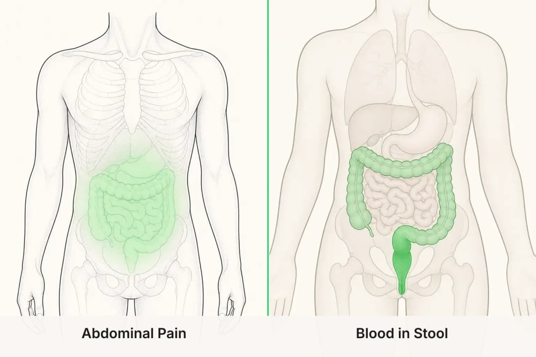 Abdominal Pain and Blood in Stool shown side by side for comparison
