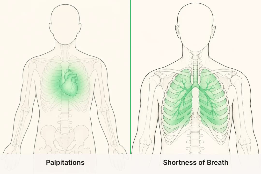 Palpitations and Shortness of Breath shown side by side for comparison