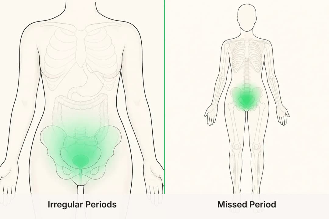Irregular Periods and Missed Period shown side by side for comparison