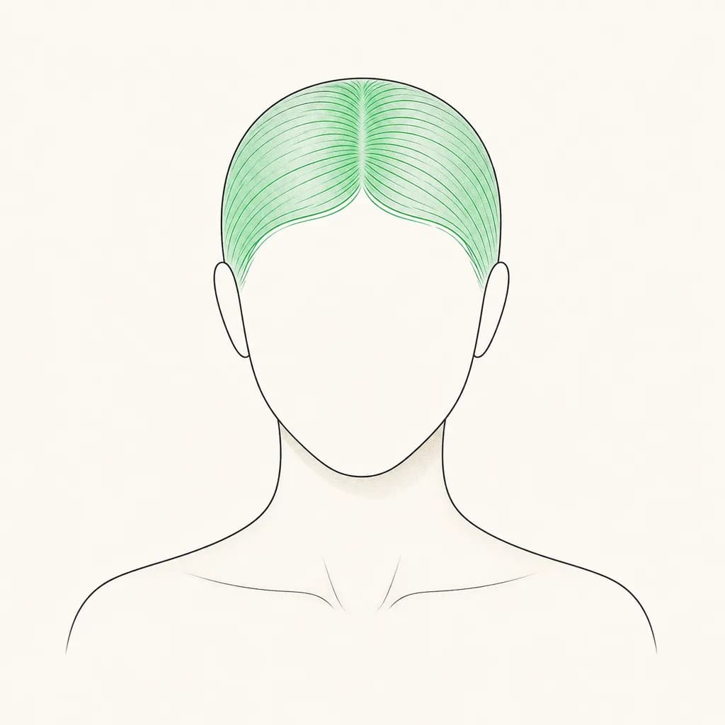 Where Hair Breakage is typically felt, shown on a simplified body outline