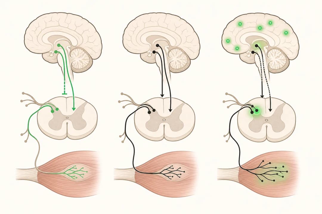 How the structures involved in Fibromyalgia differ from normal