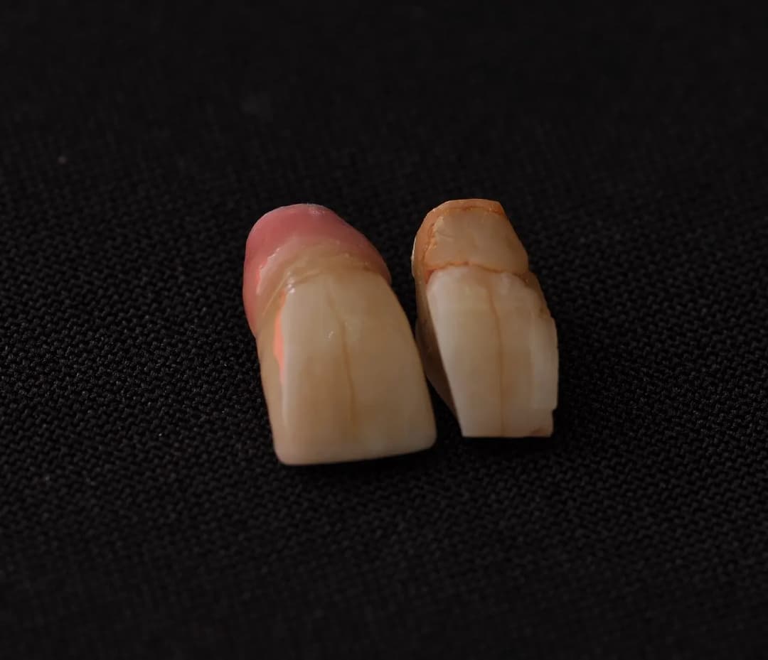 3Dent Dental Laboratory — صورة 7