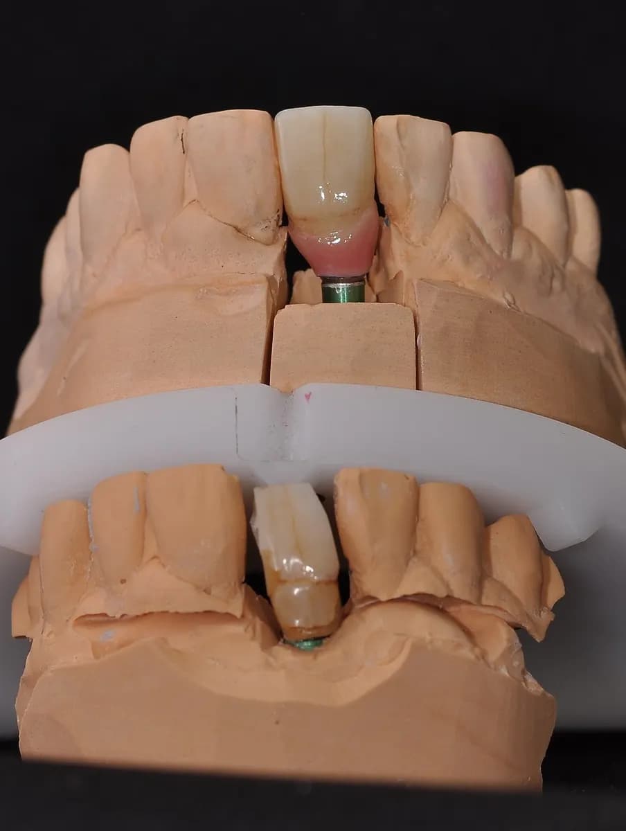 3Dent Dental Laboratory — صورة 8