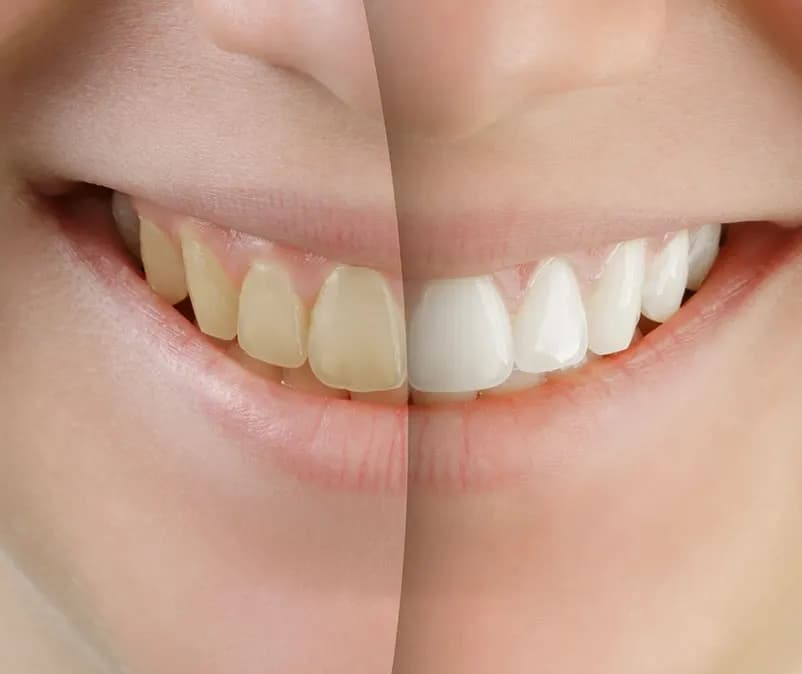Apex Dental & Orthodontic Clinic — صورة 6