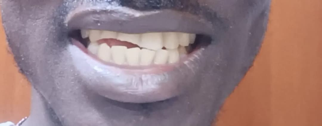 Apex Dental And Implant Clinic — صورة 4