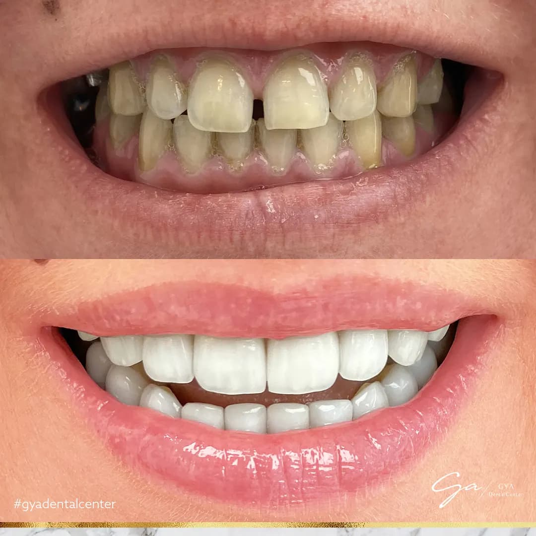 GYA Dental Center — صورة 6