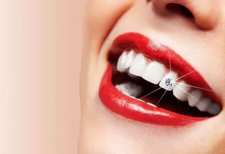 Ilham Dental Clinic — صورة 6