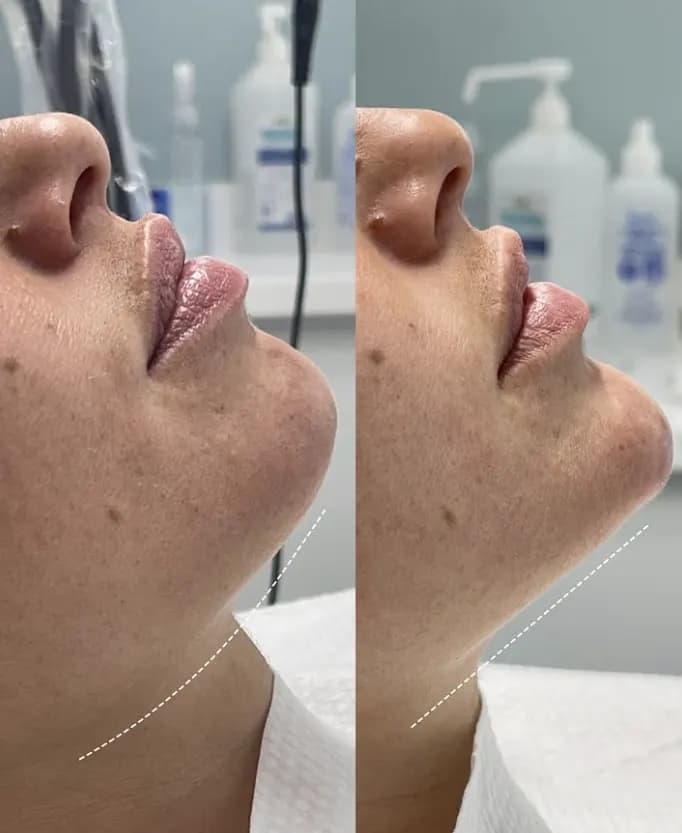 Inskin Aesthetic Medical Clinic — صورة 6