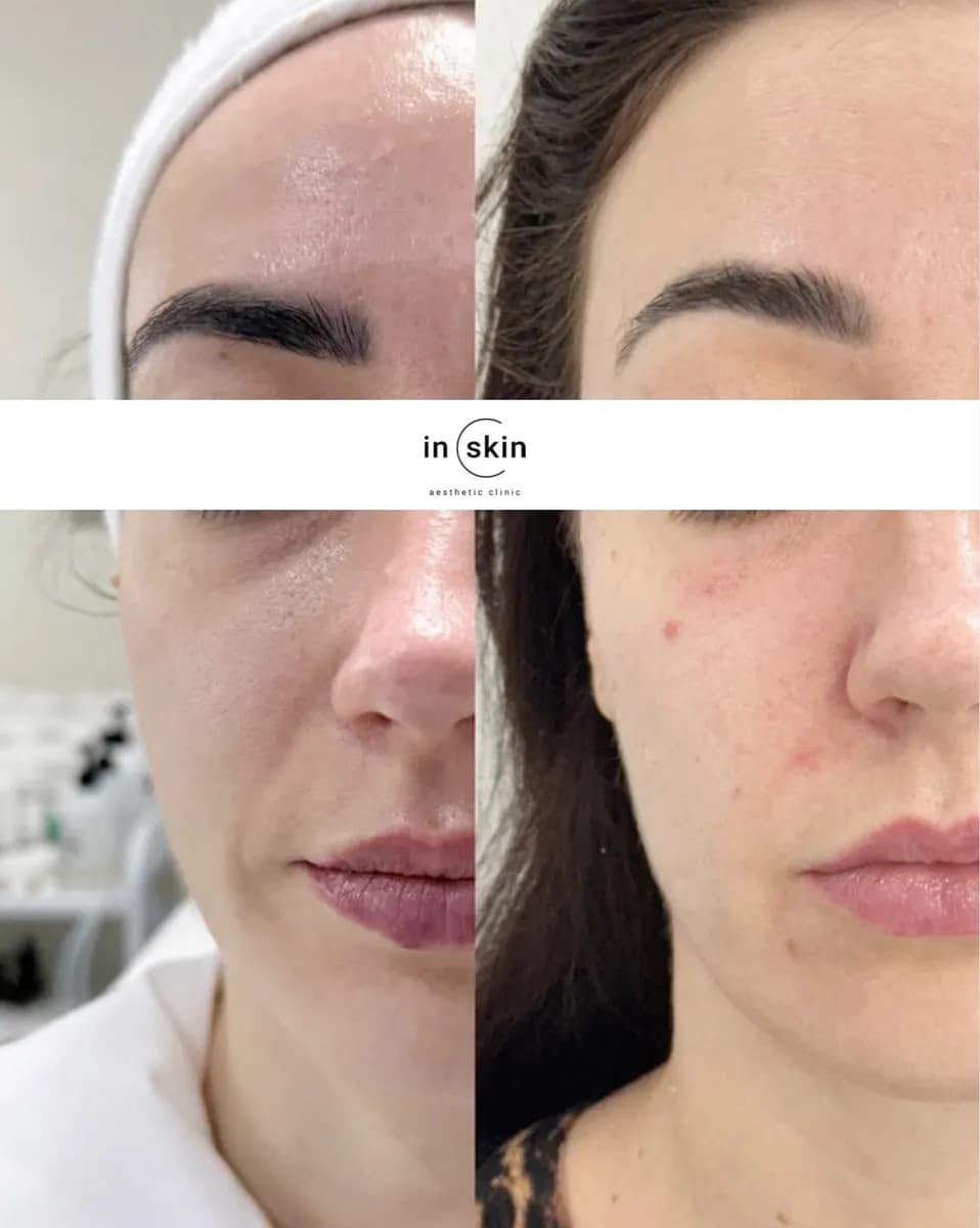 Inskin Aesthetic Medical Clinic — صورة 7