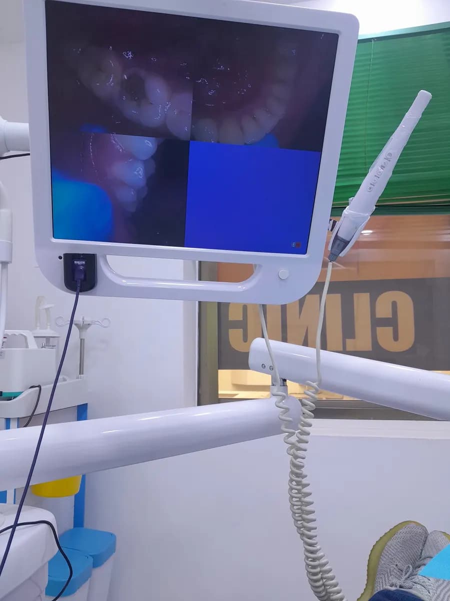 Ismile Dental Clinic — صورة 8