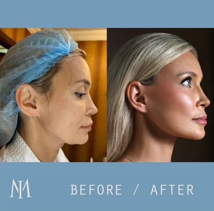 Maksym Ivanchuk Plastic Surgery Clinic — صورة 8