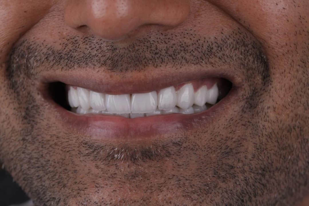 Nagem Dental Diet And Laser Center — صورة 7