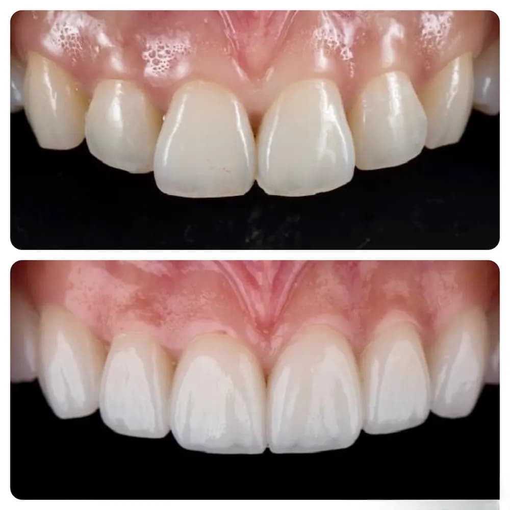 Noa Dental Clinic — صورة 7