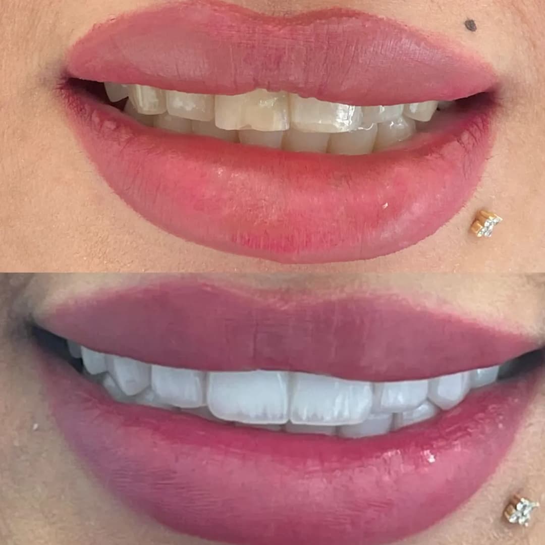 Veneers Dental Center — صورة 6