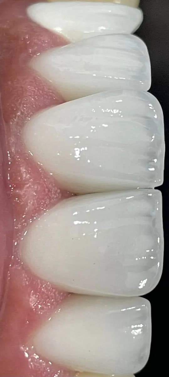 Veneers Dental Center — صورة 7