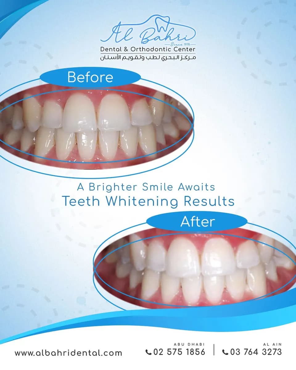 Al Bahri Dental & Orthodontic Center — صورة 3