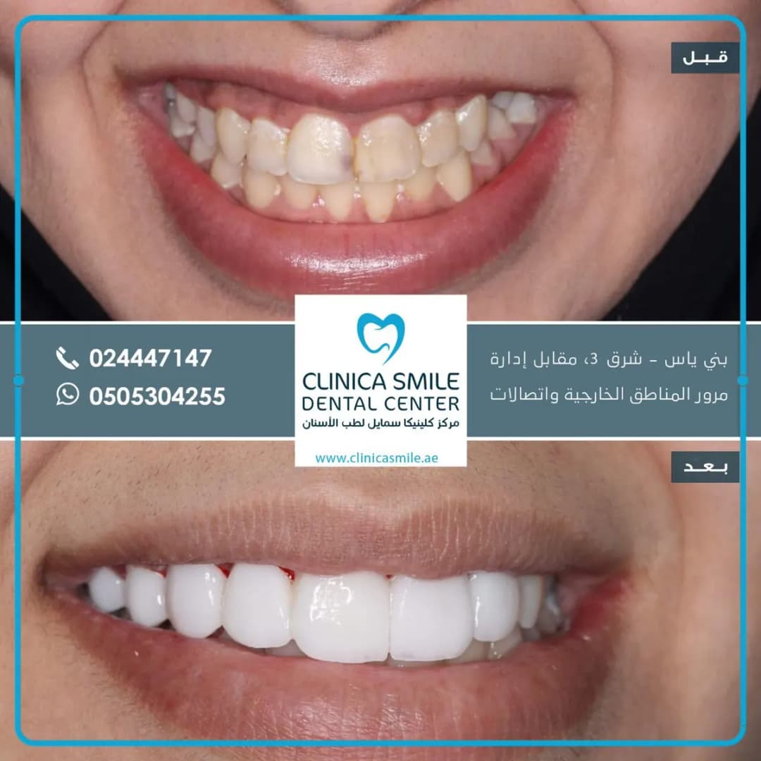 Clinica Smile Dental Center