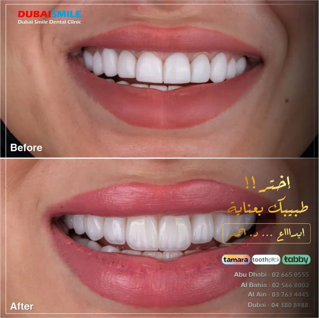 Dubai Smile Dental Clinic — صورة 2