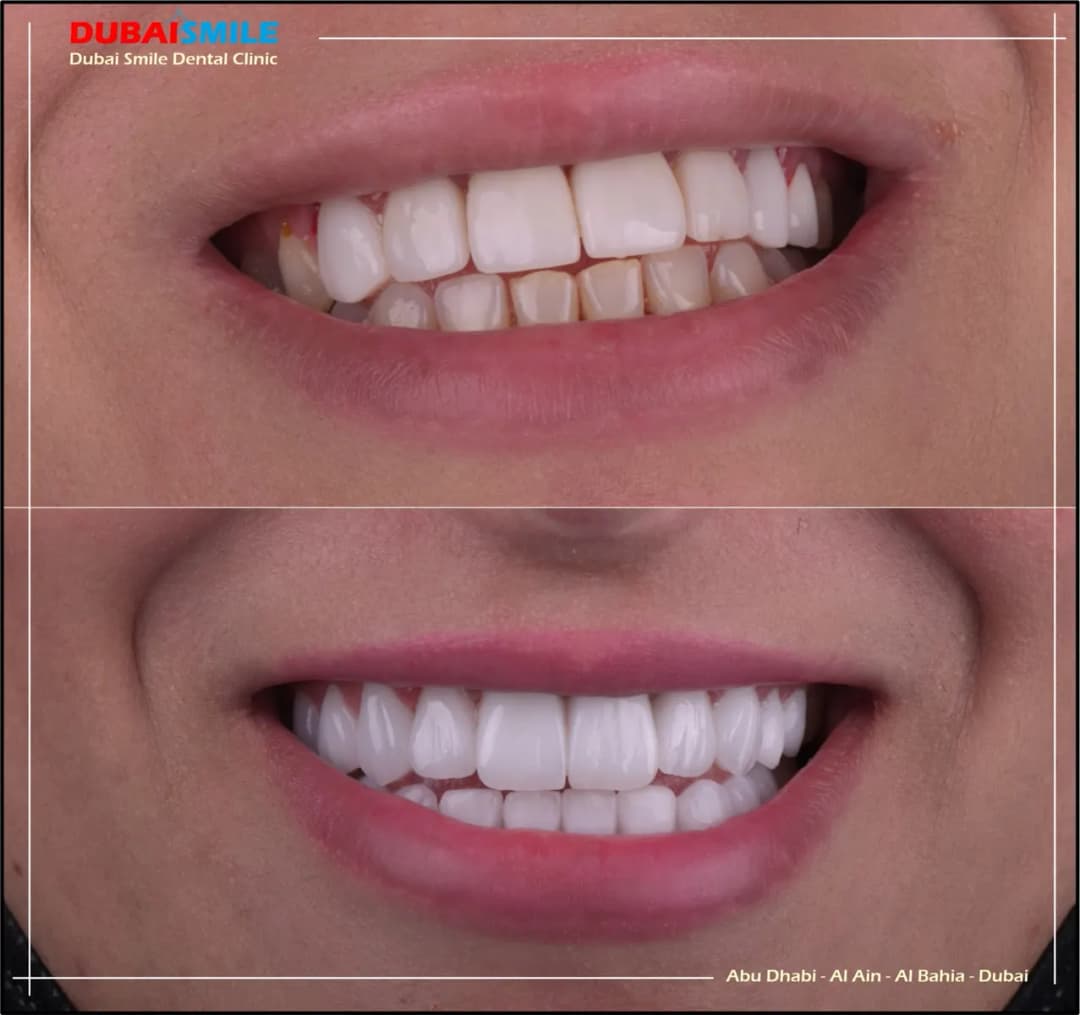 Dubai Smile Dental Clinic — صورة 5