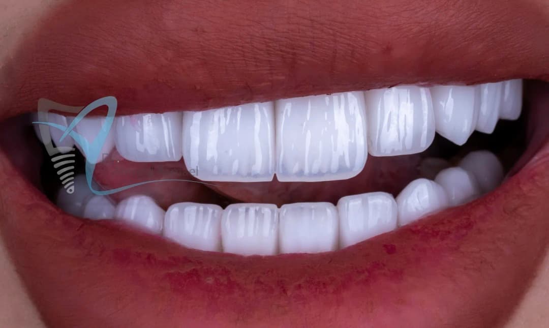 Dubai Smile Dental Clinic — صورة 7