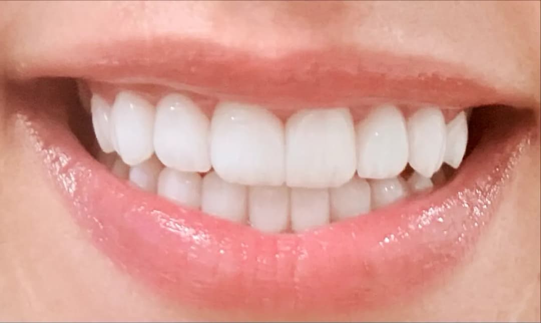 Dubai Smile Dental Clinic — صورة 8