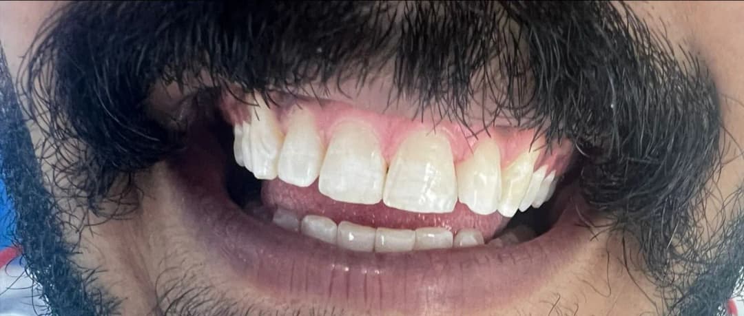 Smile Art Dental And Orthodontic — صورة 6