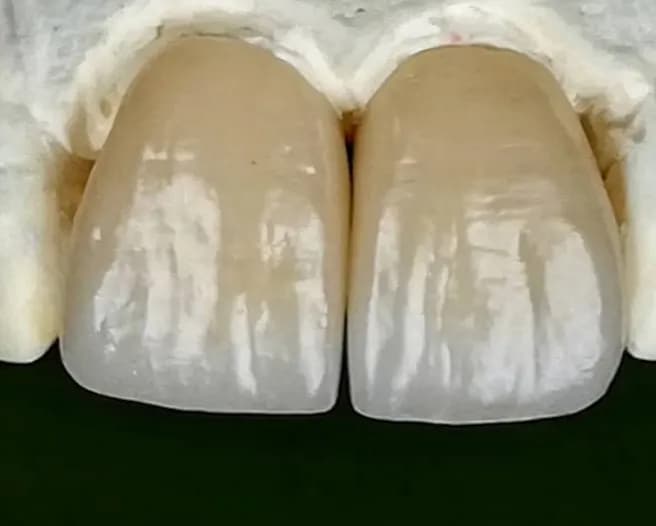Berlin Dental Clinic — صورة 8
