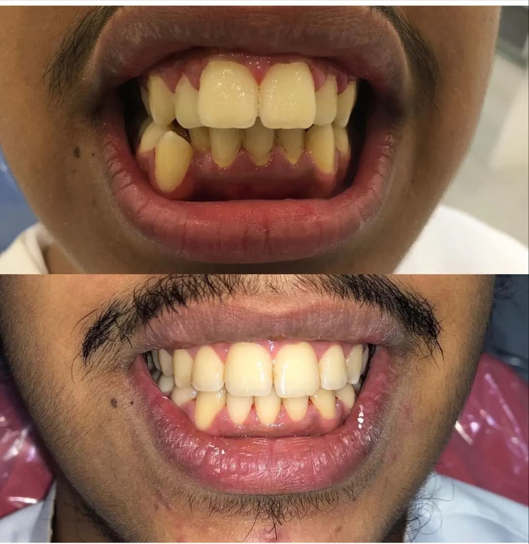 Dr.anmar Dental Center — صورة 8