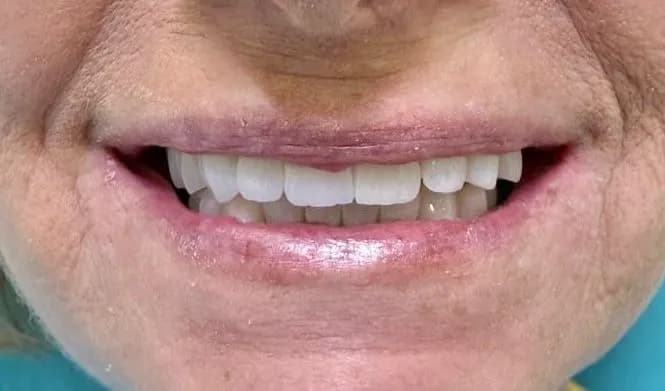 Elite Smile Dental Clinics — صورة 5