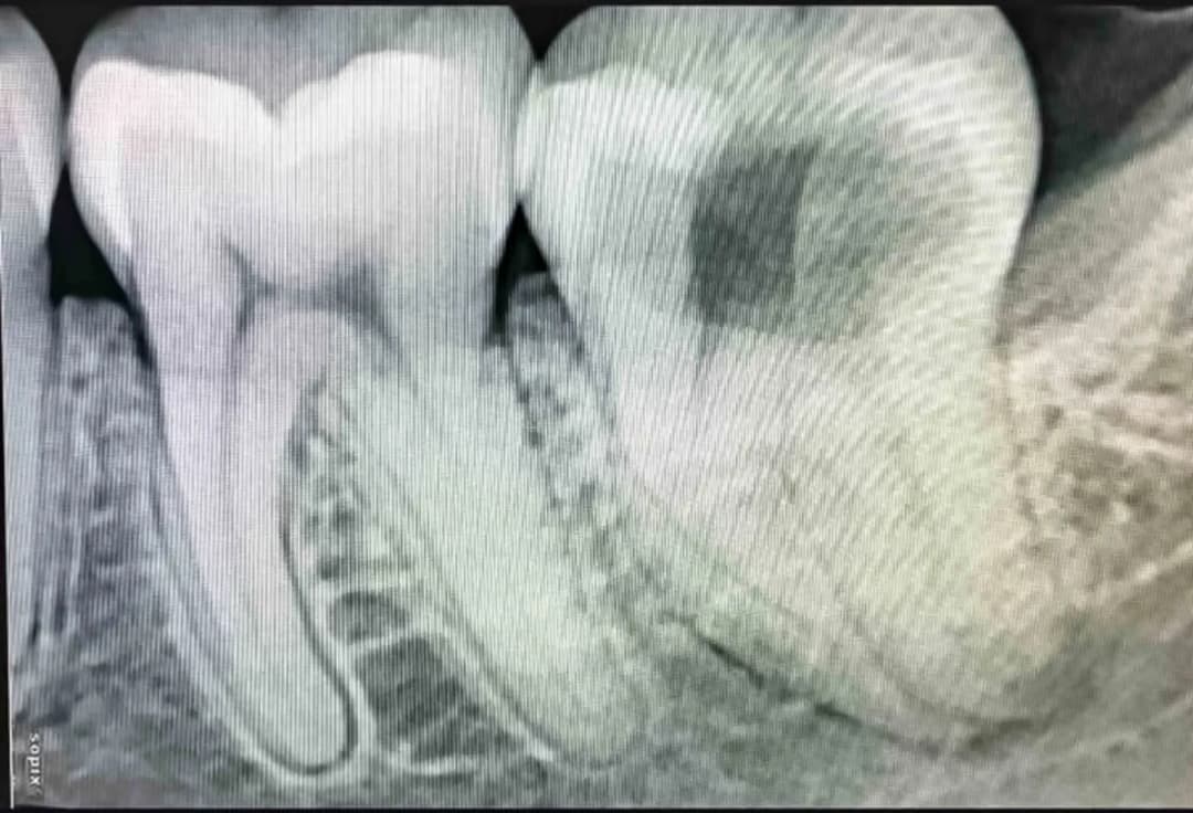 Dentism Dental Polyclinic - JLT — صورة 7