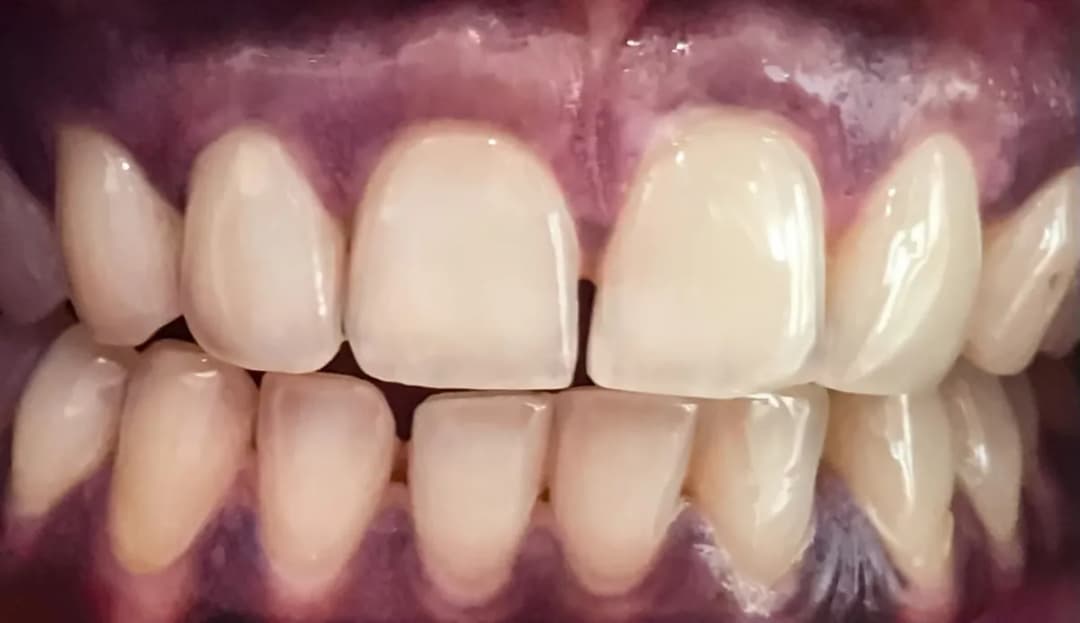 Dentism Dental Polyclinic - JLT — صورة 8