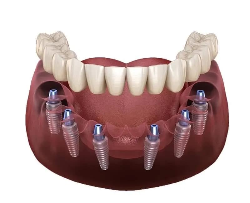 مجمع المهيدب لطب الأسنان فرع جازان — صورة 8