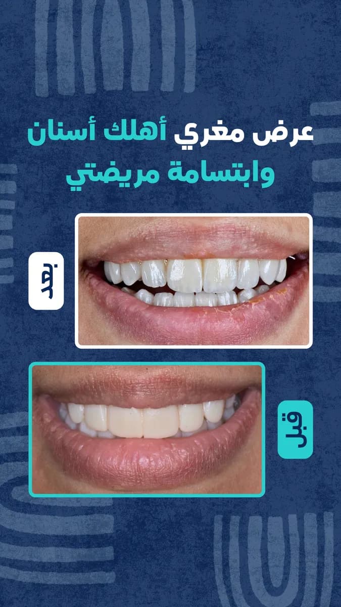 Dr.Salem Alablan