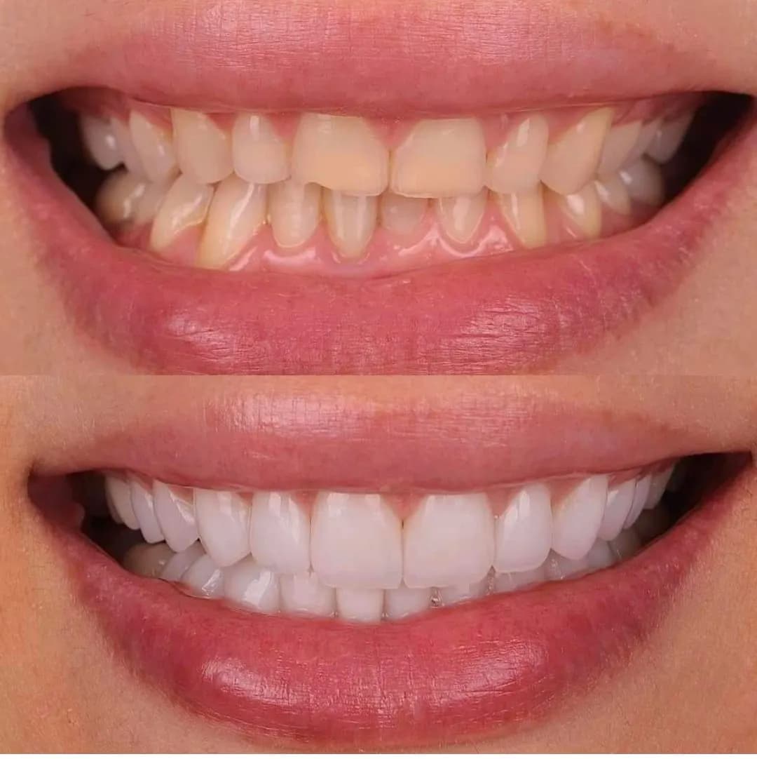 المهيدب لطب الأسنان العزيزية — صورة 5
