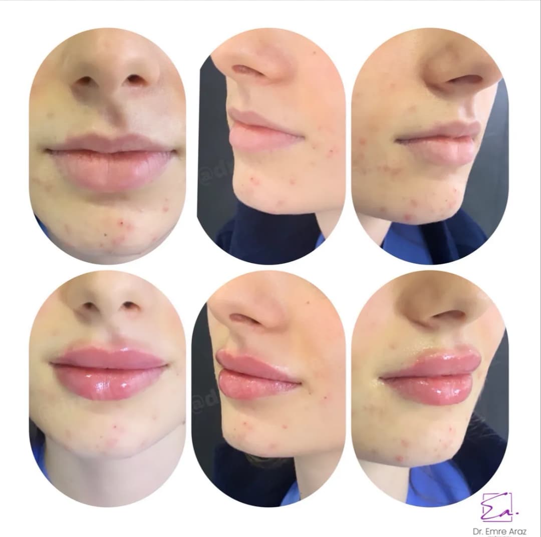 Uzm. Dr. Emre Araz | Estetik ve Klinik Dermatoloji — Dermatology & Skin Care in Istanbul