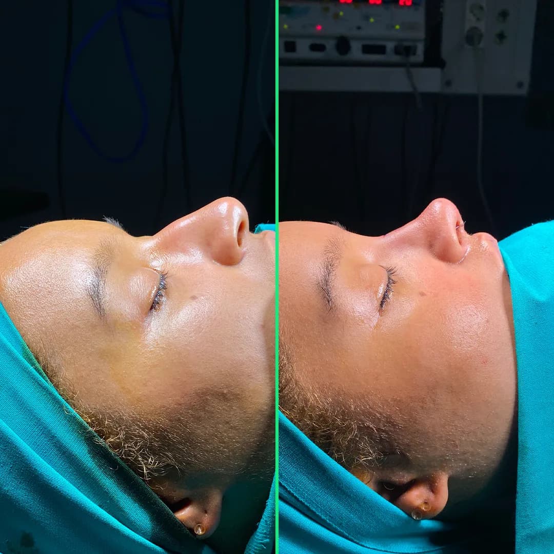Vivid Clinic | Cosmetic Surgery Istanbul, Turkey — Dental Clinics in Istanbul